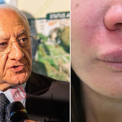 Aggressioni negli ospedali, De Luca al Ministero dell’Interno: «Garantisca sicurezza dei sanitari, altrimenti decisioni drastiche»
