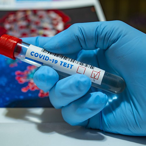 Coronavirus, sospiro di sollievo per Cava: negativi 27 tamponi