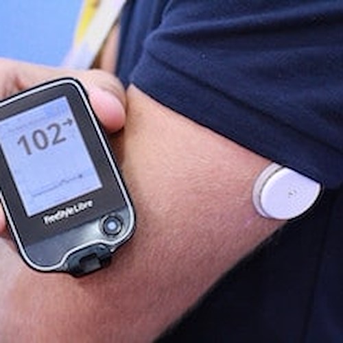 Diabete, un innovativo kit di monitoraggio glicemia per i pazienti della Campania